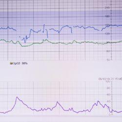 lifeline heart monitor