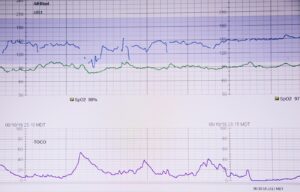 lifeline heart monitor